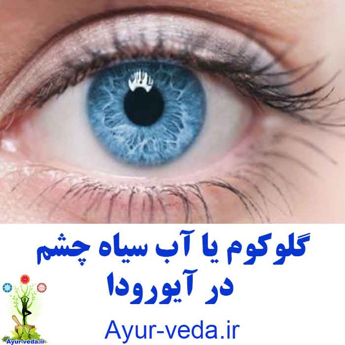 Ayurveda treat glaucoma - گلوکوم یا آب سیاه چشم در آیورودا